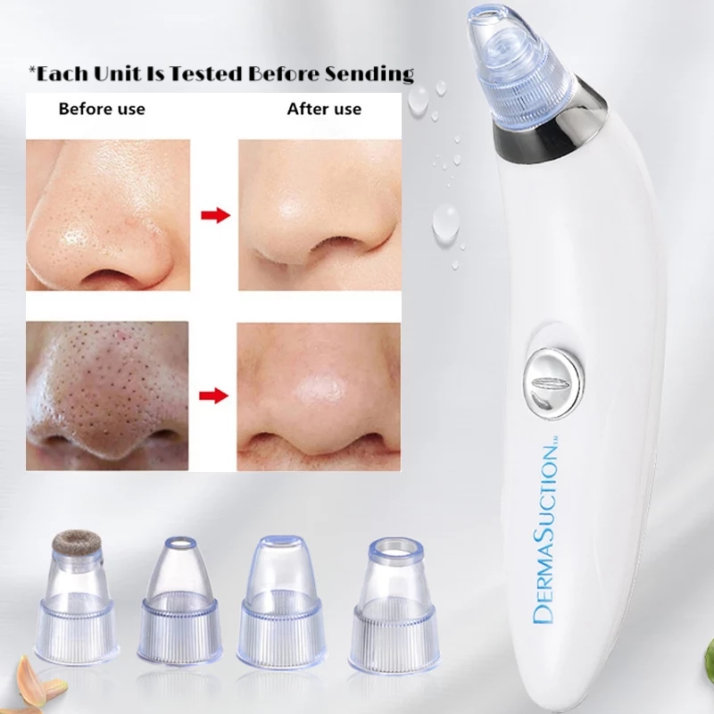 4 IN 1 DERMA VACUUM SUCTION BLACKHEAD/ACNE/OIL/PORE CLEANER